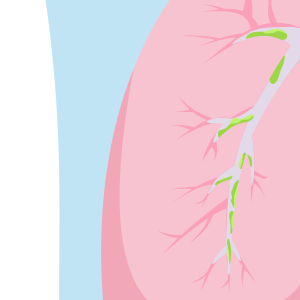 Illustration for the section 1. Initial Action