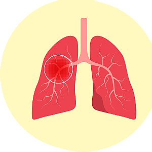 Medical Conditions That Cause Chronic Cough  product photo