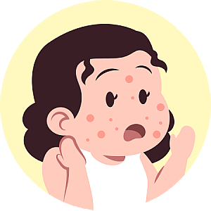 Risk of Worsening Skin Condition product photo
